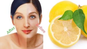 wellhealthorganic.com : remove dark spots on face tang - lemon juice